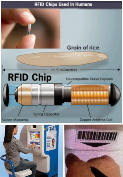 rfid aero chip mplant|first rfid implant.